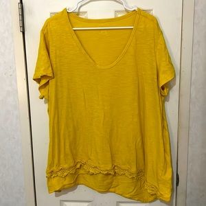 Yellow blouse with scalloped trim on front.